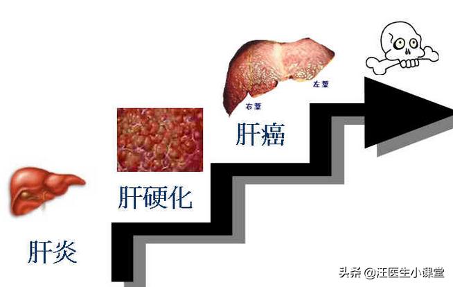 肝不好有什么症状